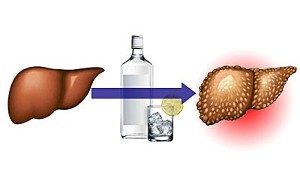 les effets de l'alcool sur le foie